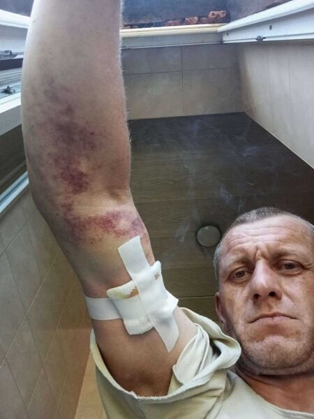 Чемпіона Всесвітньої універсіади з футболу у складі збірної України серйозно поранено на війні з росією (фото)