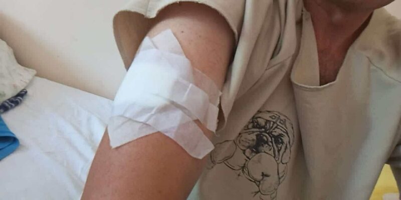 Чемпіона Всесвітньої універсіади з футболу у складі збірної України серйозно поранено на війні з росією (фото)